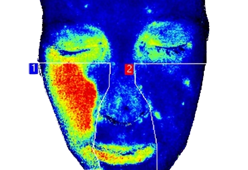 dermatology face