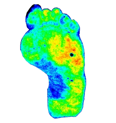 diabetic foot perimed psi hr