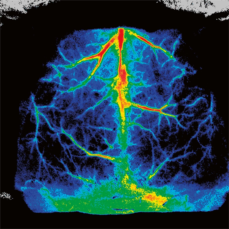 pericam psi regions of interest