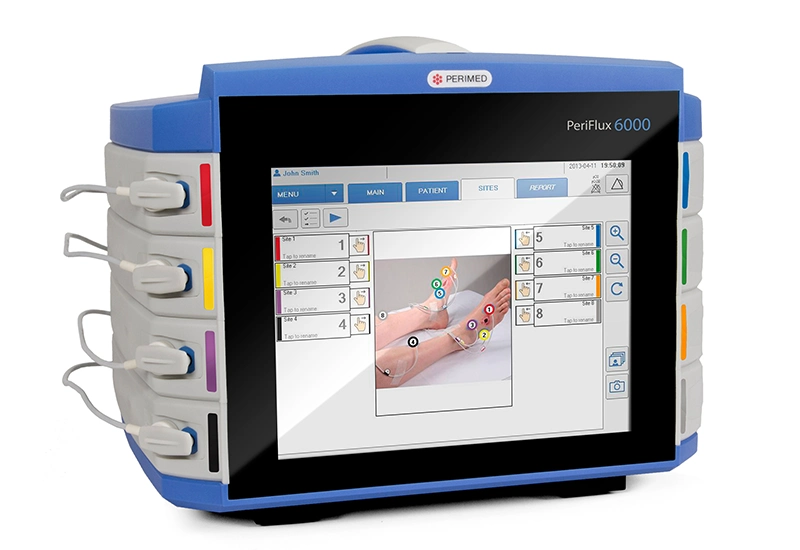 periflux 6000 tcpo2 standalone sites