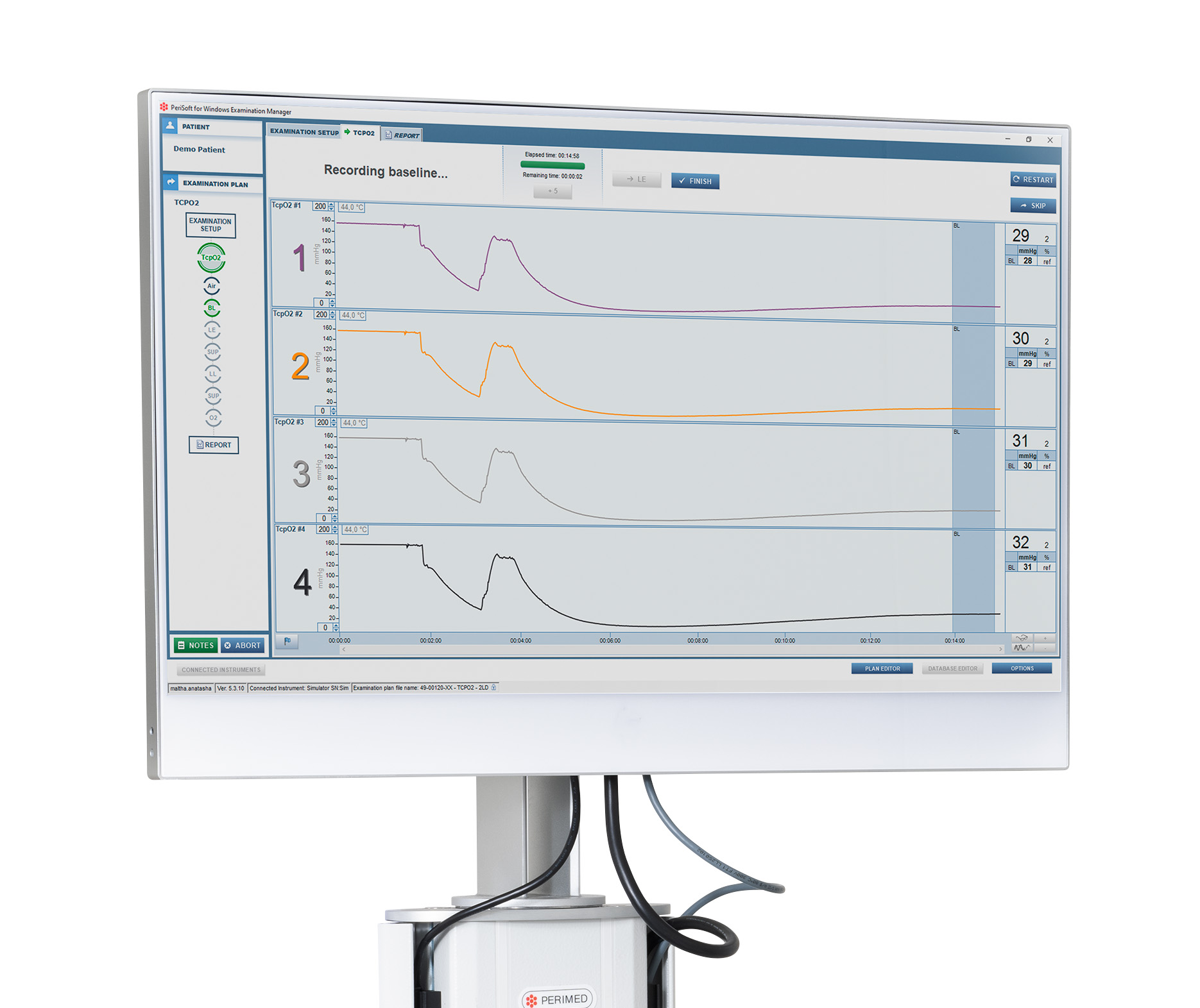 perimed intuitive interface tcpo2