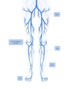 perimed vascular illustration