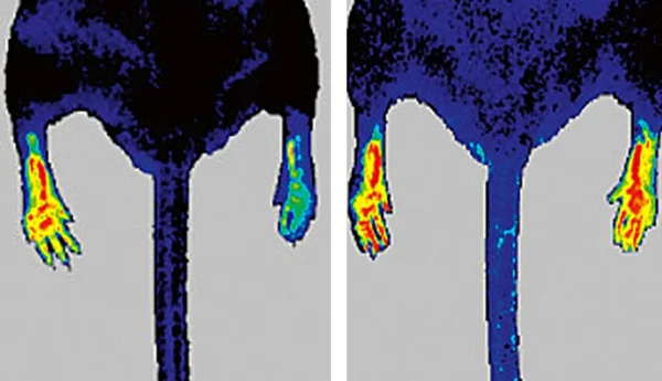 Hindlimb ischemia