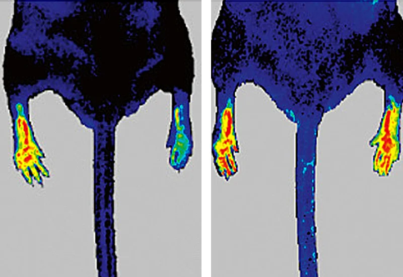 Hindlimb ischemia