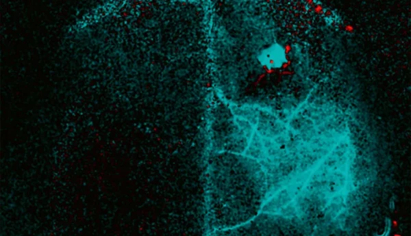 Cerebral blood flow monitoring