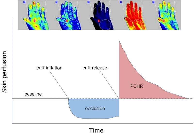 post occlusive reactive hyperemi pohr